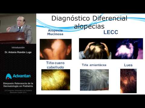 Il delactosed si mescola a dermatite atopic Neurodermatitis i prodotti vietati