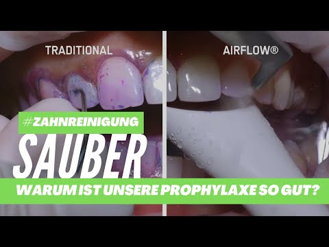 Warum ist die KU64-Prophylaxe so gut? Vergleich: NORMALE ZAHNREINIGUNG vs AIRFLOW (GBT by EMS)