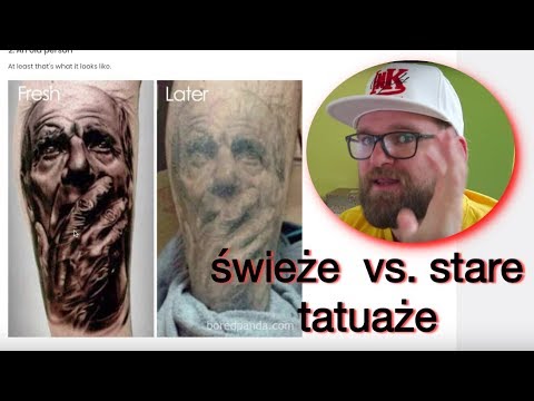 Halgus koślawego pro Jak usunąć kości na piechotę na palucha