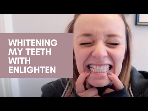download lagu mp3 mp4 Enlighten Tooth Serum Reviews, download lagu Enlighten Tooth Serum Reviews gratis, unduh video klip Download Enlighten Tooth Serum Reviews Mp3 dan Mp4 Music Online Gratis