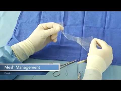 MESH MANAGEMENT for Robotic Sacrocolpopexy
