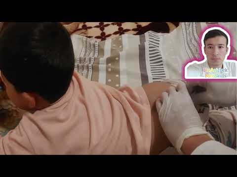 Suppository for Babies and Kids — Safe & Easy Technique