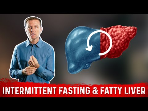 4 Critical Tips to Reverse a Fatty Liver – Dr Berg