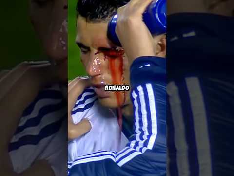 Ronaldo almost died?!😳🥲Wait until the end!🤔