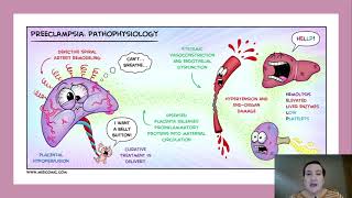 Unit 3a1 Hypertension