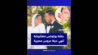 قبل أيام قليلة من حفل زفافها.. حقنة بوتوكس مغشوشة تنهي حياة عروس مصرية thumbnail