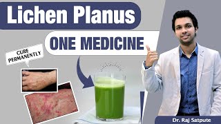 One Medicine To Cure Lichen Planus Skin Disease Naturally & Permanent *Results From First Week*