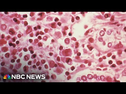 What is the Hantavirus?