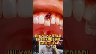 Download lagu BE CAREFUL IF YOUR TOOTH FALLS OUT AND IS SWALLOWED #truestory #facts mp3