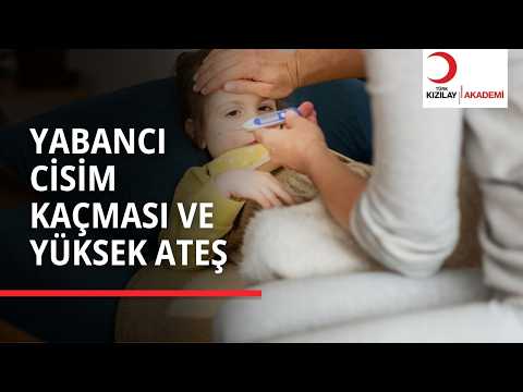 Ateşi Çıkan Birine Sirke Sürülür Mü?