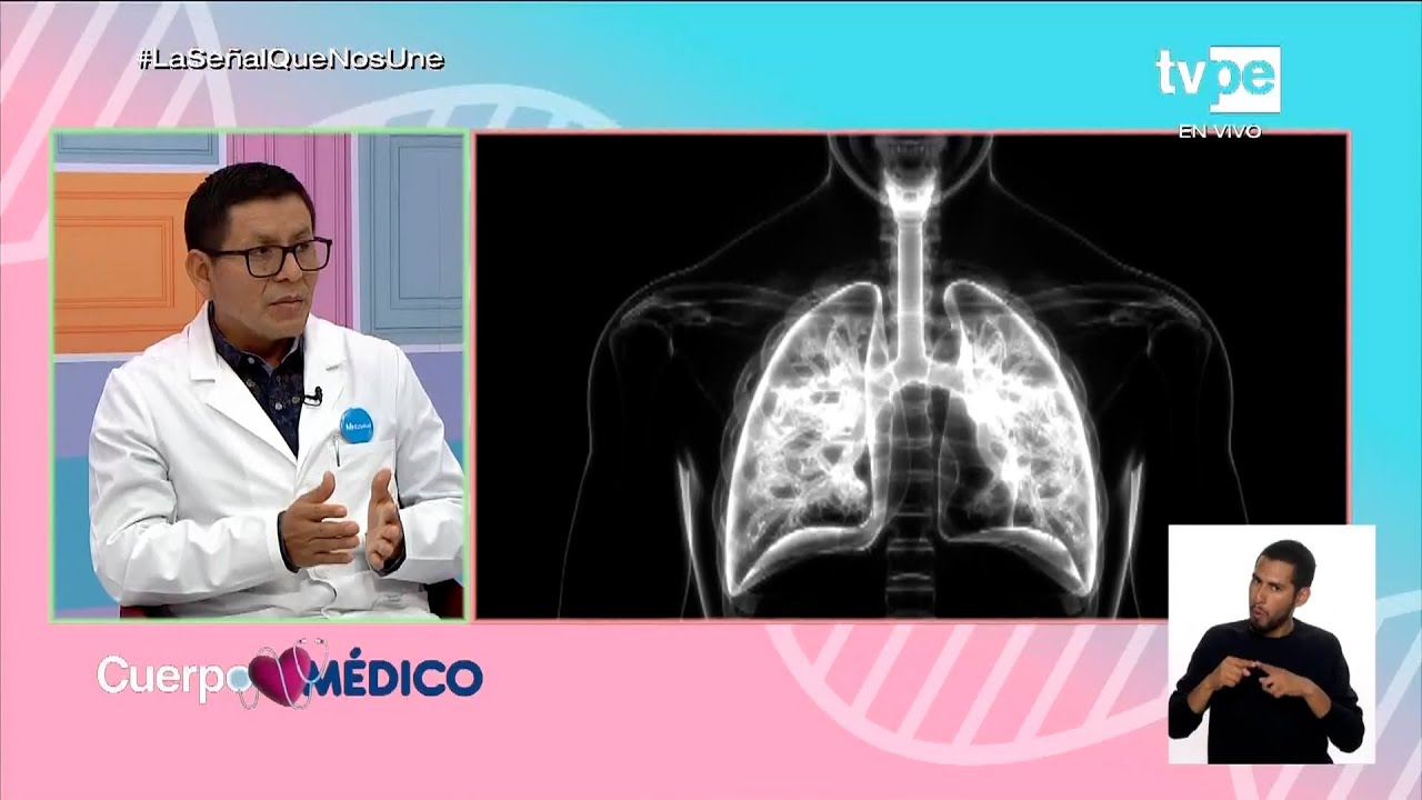 Ronald Rupire Misaico-14