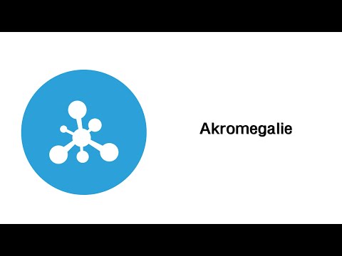 Akromegalie - Erkrankungen der endokrinen Organe und Stoffwechselregulation (mit Infoleiste)