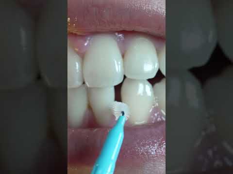 How to use interdental brushes