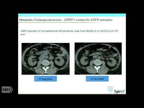 Comprehensive Molecular Profiling to Support Treatment Recommendations for Advanced Cancer