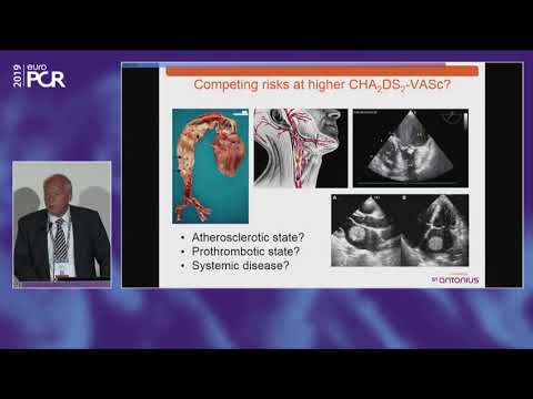 Left atrial appendage closure - a case based discussion