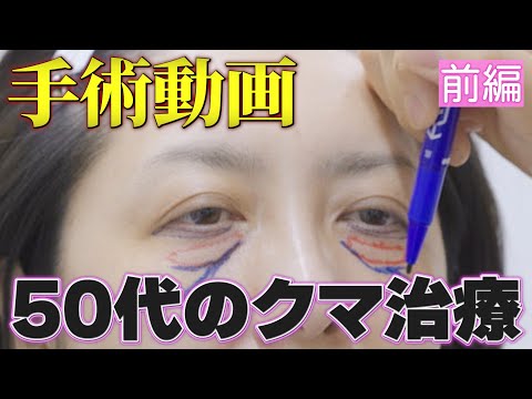 医学科 【前編】50代のクマ治療（表ハムラ法）│デザイン解説