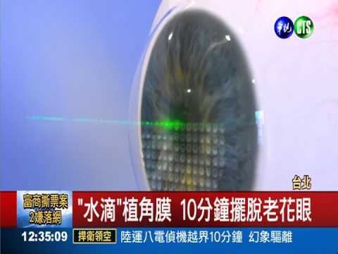 "水滴凝膠"植角膜 擺脫老花眼