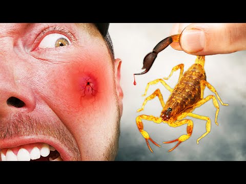 PAINFUL STING From One of Asia's Meanest Scorpions!