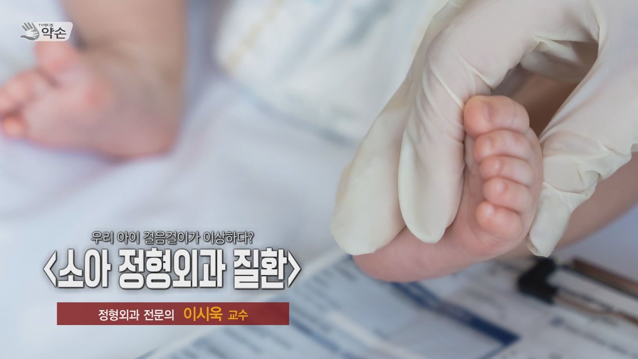 우리 아이 걸음걸이가 이상하다? '소아 정형외과 질환' ㅣ 정형외과 이시욱 교수