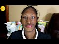 Living With One Of The World S Rarest Syndromes The Story Of Sweet P