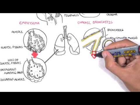 Descripción general de la enfermedad pulmonar obstructiva crónica (tipos, patología, tratamiento)