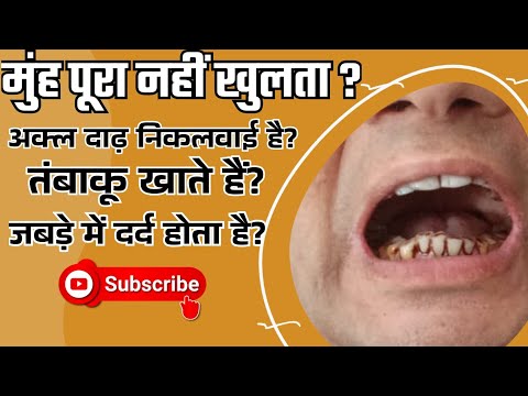 Mundöffnungsübungen: Wie öffnet man den Mund mit einem Eisstiel? Wie macht man Kieferübungen? Dr....