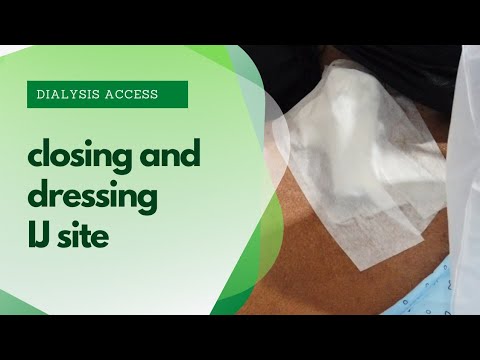 How to close and dress IJ catheter properly post dialysis