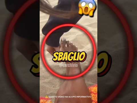ECCO CHE FARE SE CALPESTI UN PESCE RAGNO 🇮🇹😱 #curiosità #informative