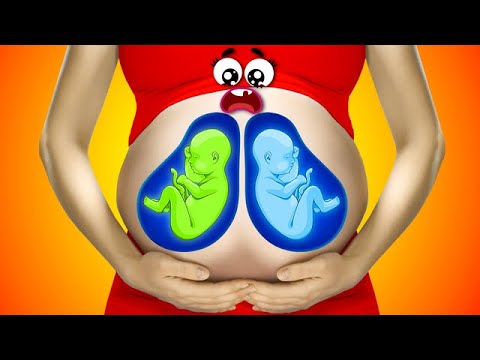 OOPS! Unexpected Moments From The Life Of Crazy Doodles || Daily Fails And Struggles By Doodland