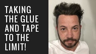 Hair Replacement Hair System Review Taking the Glue and Tape to the Limit!
