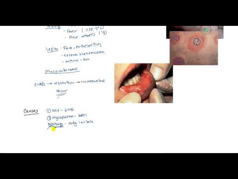Steven-Johnson-Syndrom (SJS), Toxische epidermale Nekrolyse (TEN) und Erythema multiforme für USMLE