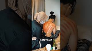 Download lagu Kerokan Skin Rubbing π€― mp3 Download lagu Kerokan Skin Rubbing π€― mp3