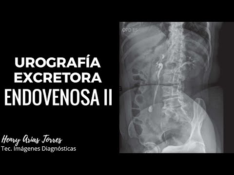 Il video tutorial di massaggio prostatite Esercizio con le pietre in prostata