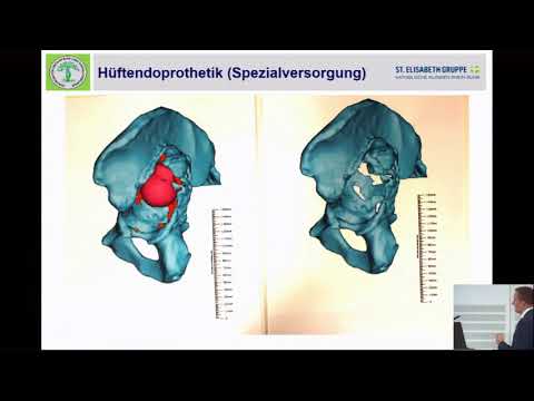Vorbereitung von Schmerzen und Entzündungen in den Gelenken Muskelschmerzen auf der linken Seite