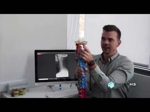 Lower North Shore Cremorne Headache Relief - Why Headache Sufferers Need X Rays