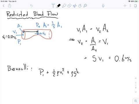 Finding the pressure for restricted blood flow has never been easier!