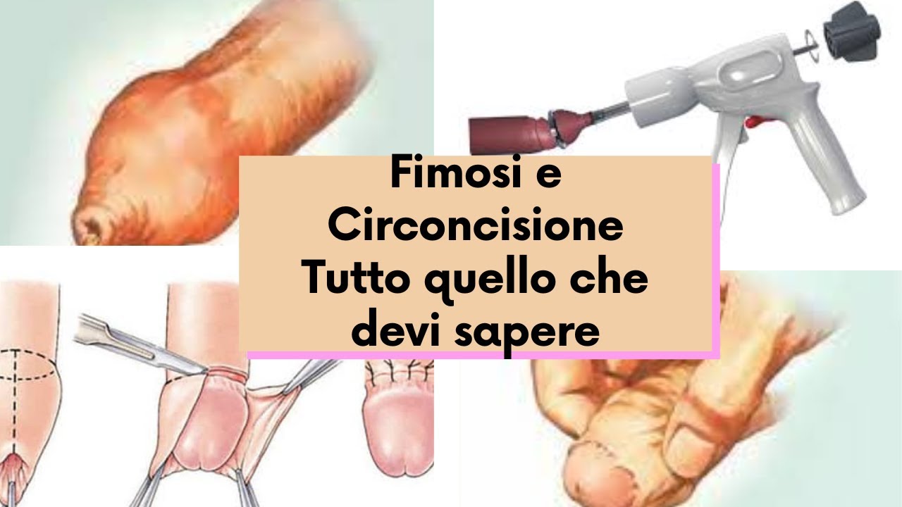 Pier Andrea Della Camera-21