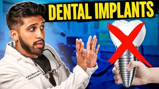 Dental Implants EXPOSED: Its NOT Your Best Option! (Dentist Explains)