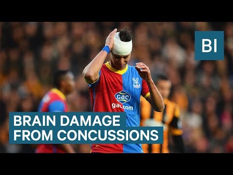 What happens to your brain during a concussion