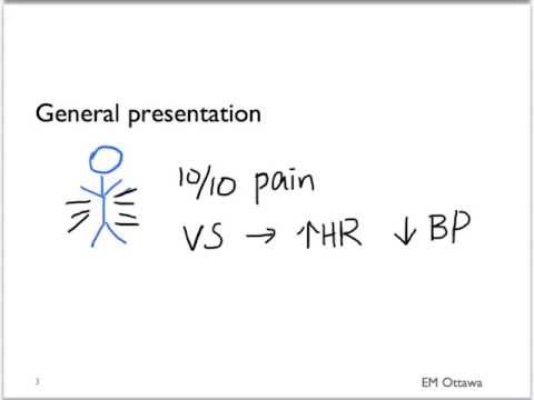 download lagu mp3 mp4 Perforated Viscus, download lagu Perforated Viscus gratis, unduh video klip Perforated Viscus
