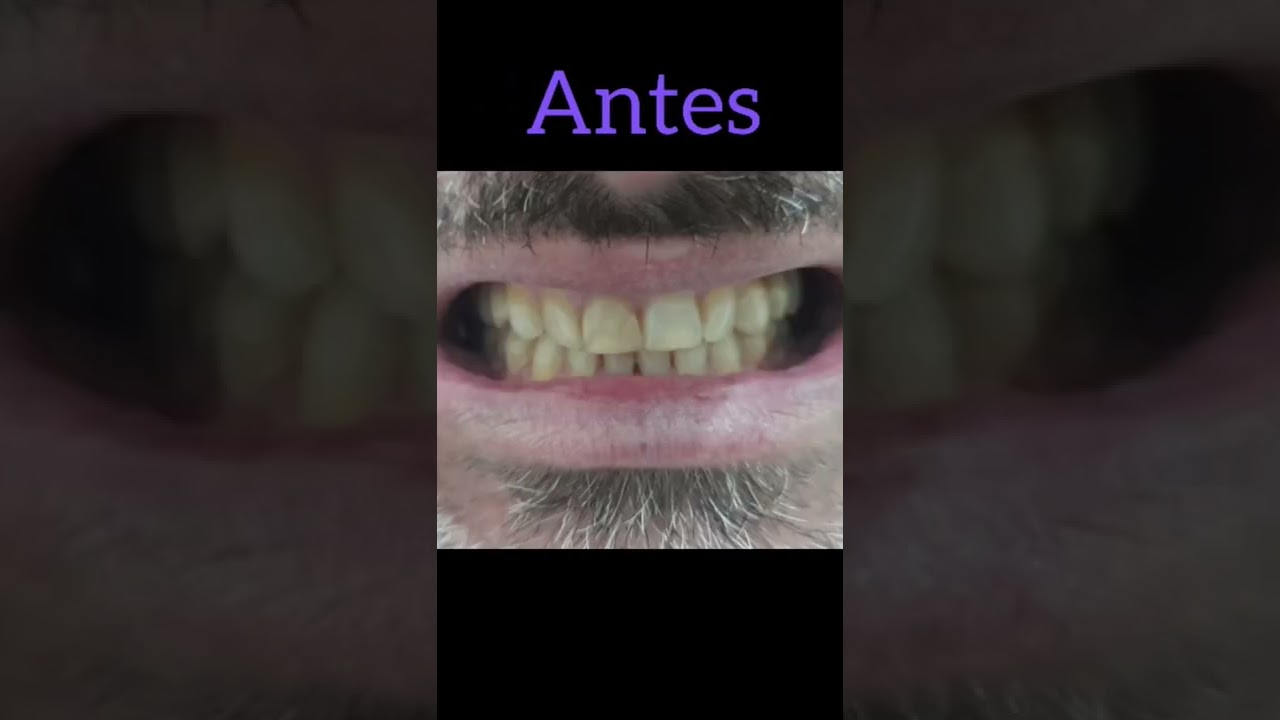 Gislene Isabel De Mendonça-27