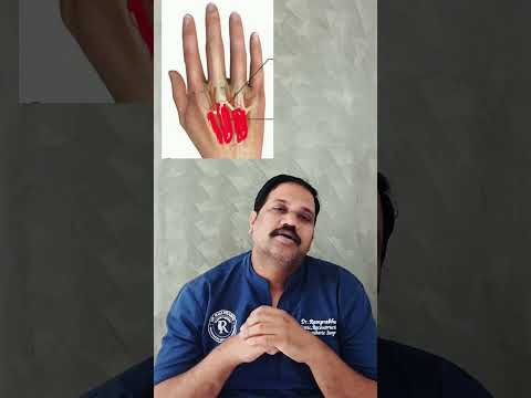 Wrist swelling and tenosynovitis short video thumbnail by Dr. Ram Prabhu.