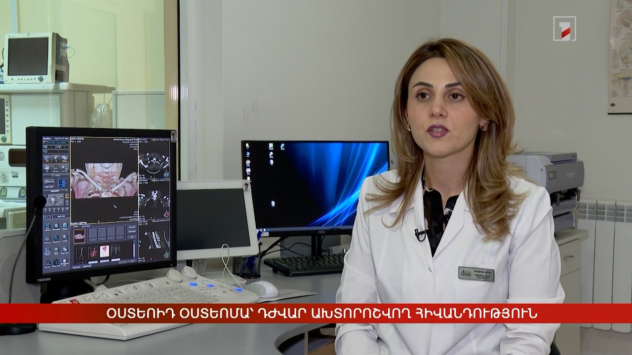 Օստեոիդ օստեոմա՝ դժվար ախտորոշվող հիվանդություն
