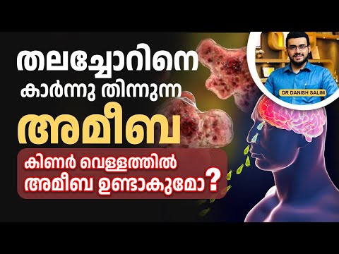2317 : ബ്രെയിൻ ഈറ്റിംഗ് അമീബ - കുടിവെള്ളത്തിലൂടെ പകരുമോ ? |  Brain-Eating Amoeba?