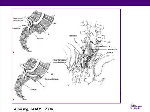 Pediatric Spine - ABOS Orthopedic Surgery Board Exam Review