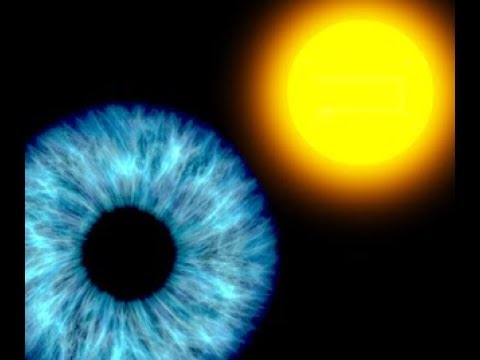 Il dolore di occhio lampeggiando anche si è gonfiato Occhio hypostasis a un pungiglione di un moscerino