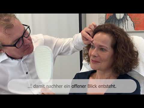 [Oberlidstraffung ohne große OP!!] 😱 😱  | Ganz einfach mit neuer Klebetechnik |