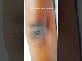 Elbow Night Care Routine | How to get rid of Dark elbow | Elbow lightening #shorts #darkelbows