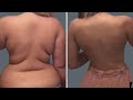 BYE BYE BELLY FAT AND LOVE HANDLE Standing Exercise To Lose Belly Fat