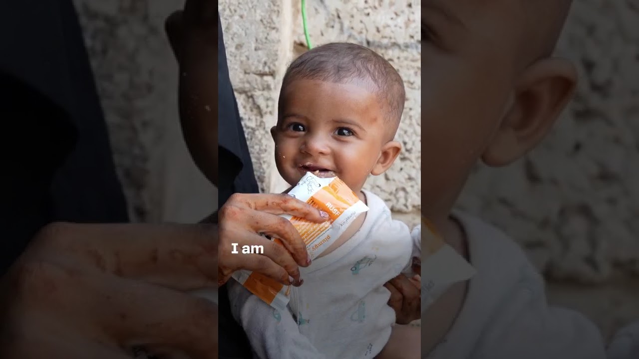 Be a monthly donor and save lives, send Ready-to-Use Therapeutic Food (RUTF) to children in need.